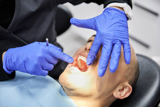 Best Emergency Tooth Extraction in Polo, IL